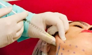 Como criar um protocolo eficaz de emagrecimento com intradermoterapia