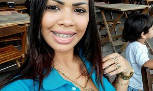 angela-danos-esteticos