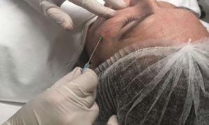 Quais cursos fazer para ter retorno financeiro rápido na farmácia estética?