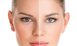 skinbooster-estetica