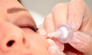 carboxiterapia facial