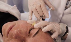 Paciente Modelo - Farmácia Estética