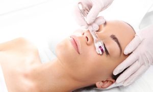 drug delivery associado ao microagulhamento