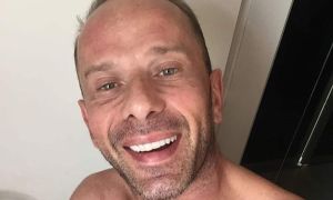 rafael ilha harmonização facial