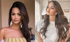 filha-kelly-key-antes-e-depois-procedimentos