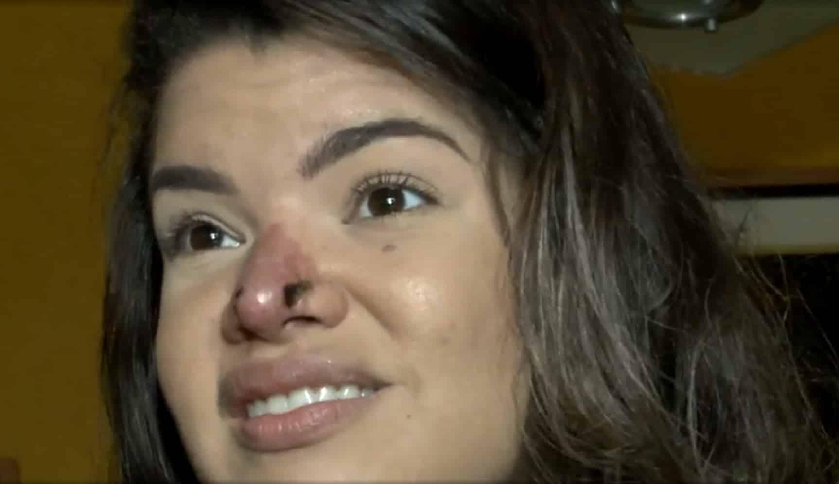 Priscilla Aguiar - Rinomodelação